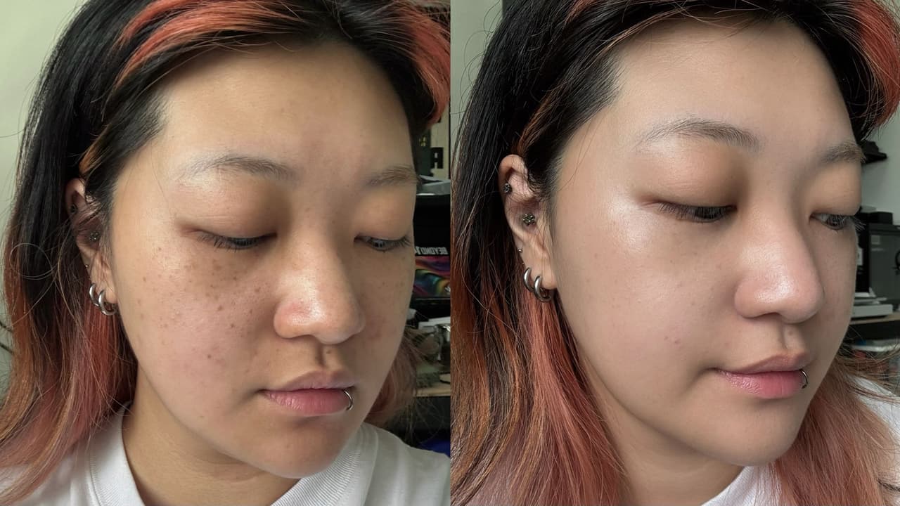 megapx