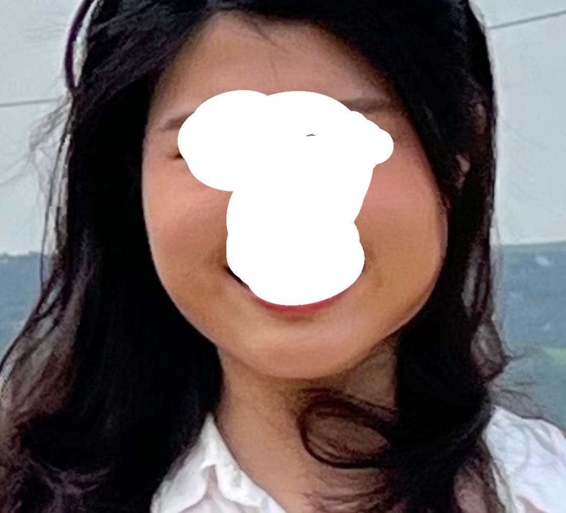 megapx