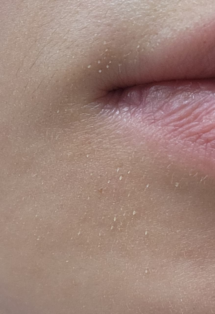 megapx
