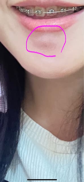 megapx