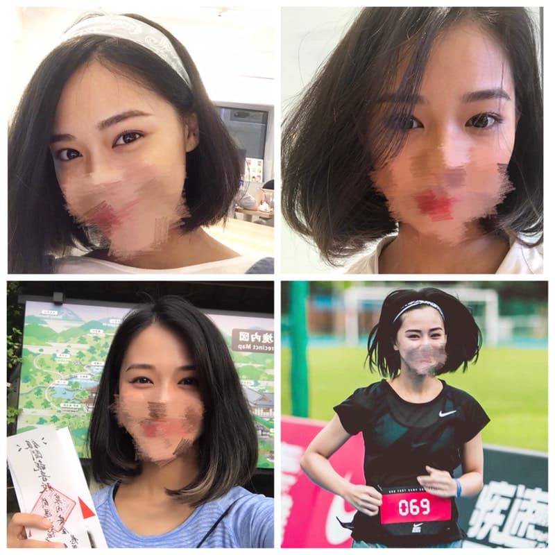 megapx