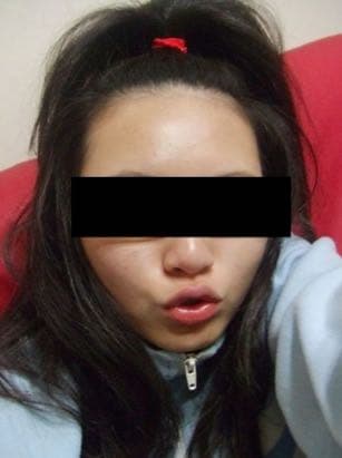 megapx