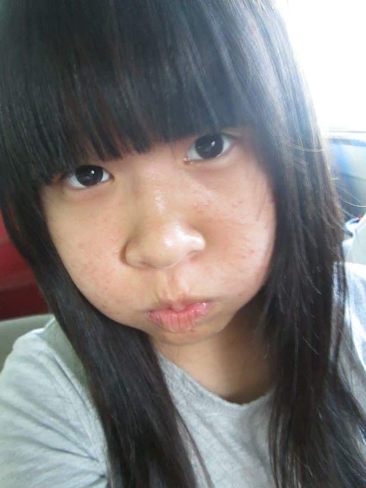 megapx