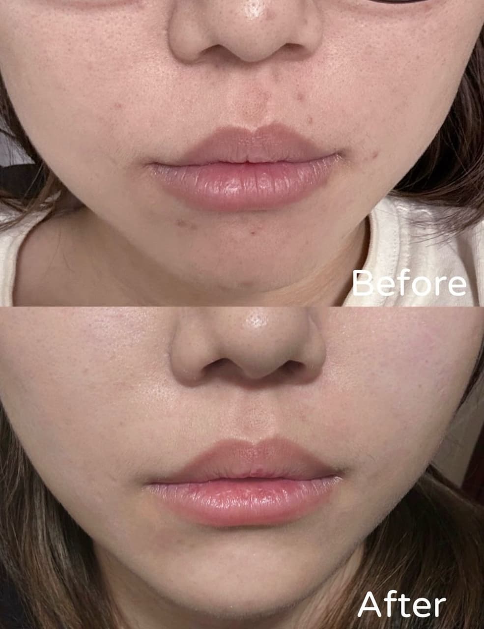 megapx