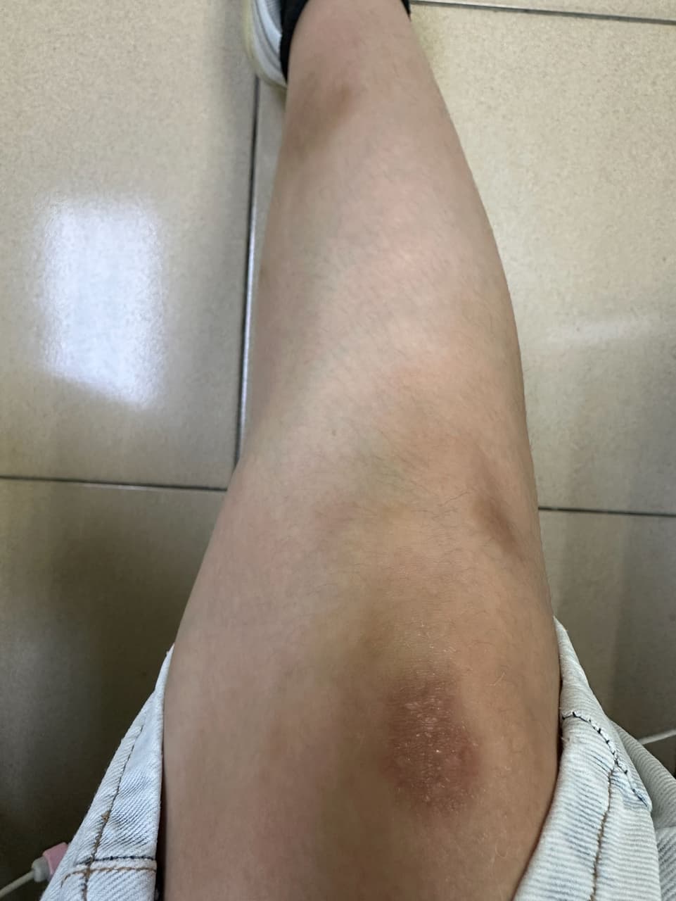 車禍和解的精選文章與討論｜Dcard