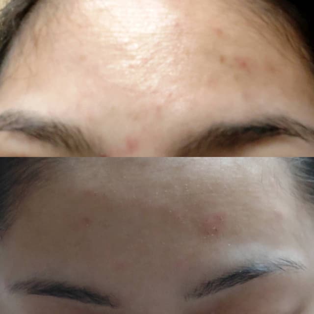 megapx