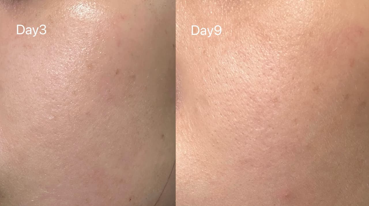 megapx
