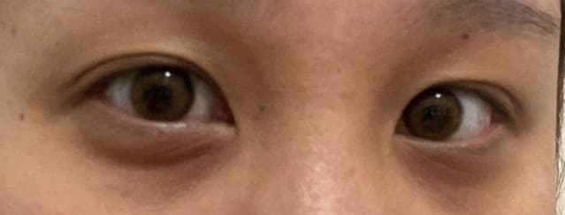 請益MAC六色遮瑕盤Medium怎麼遮 - 美妝板