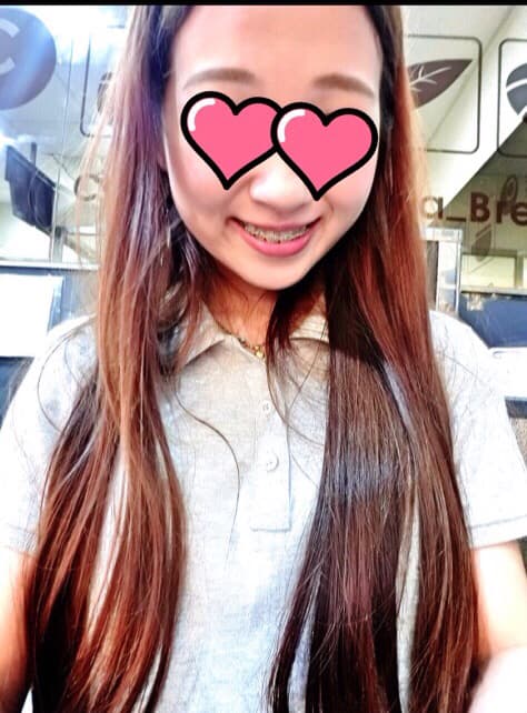 megapx