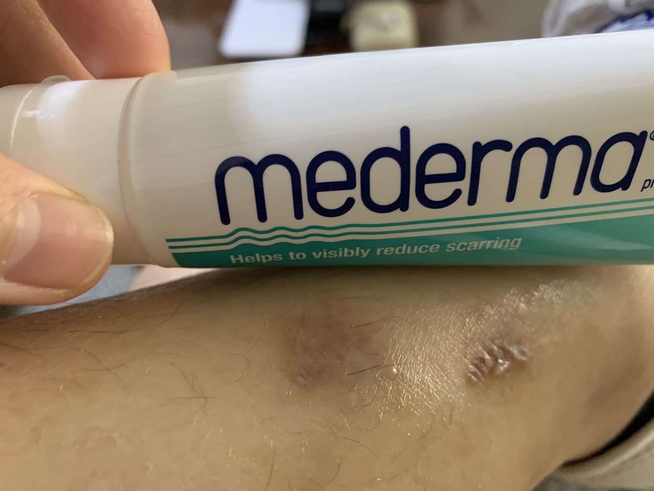 megapx