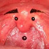 外科醫。懸雍垂哥