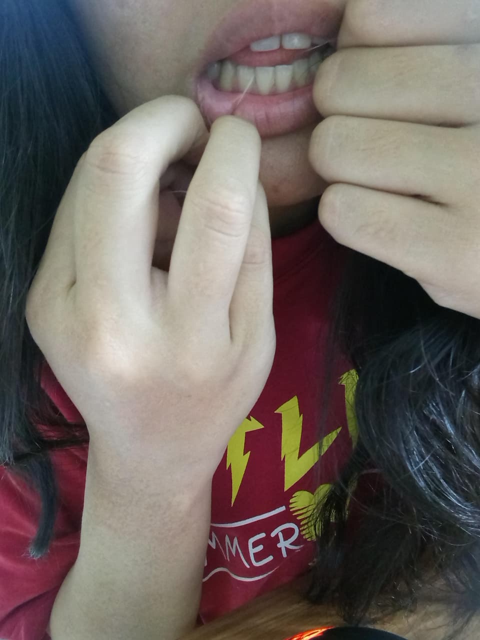 megapx
