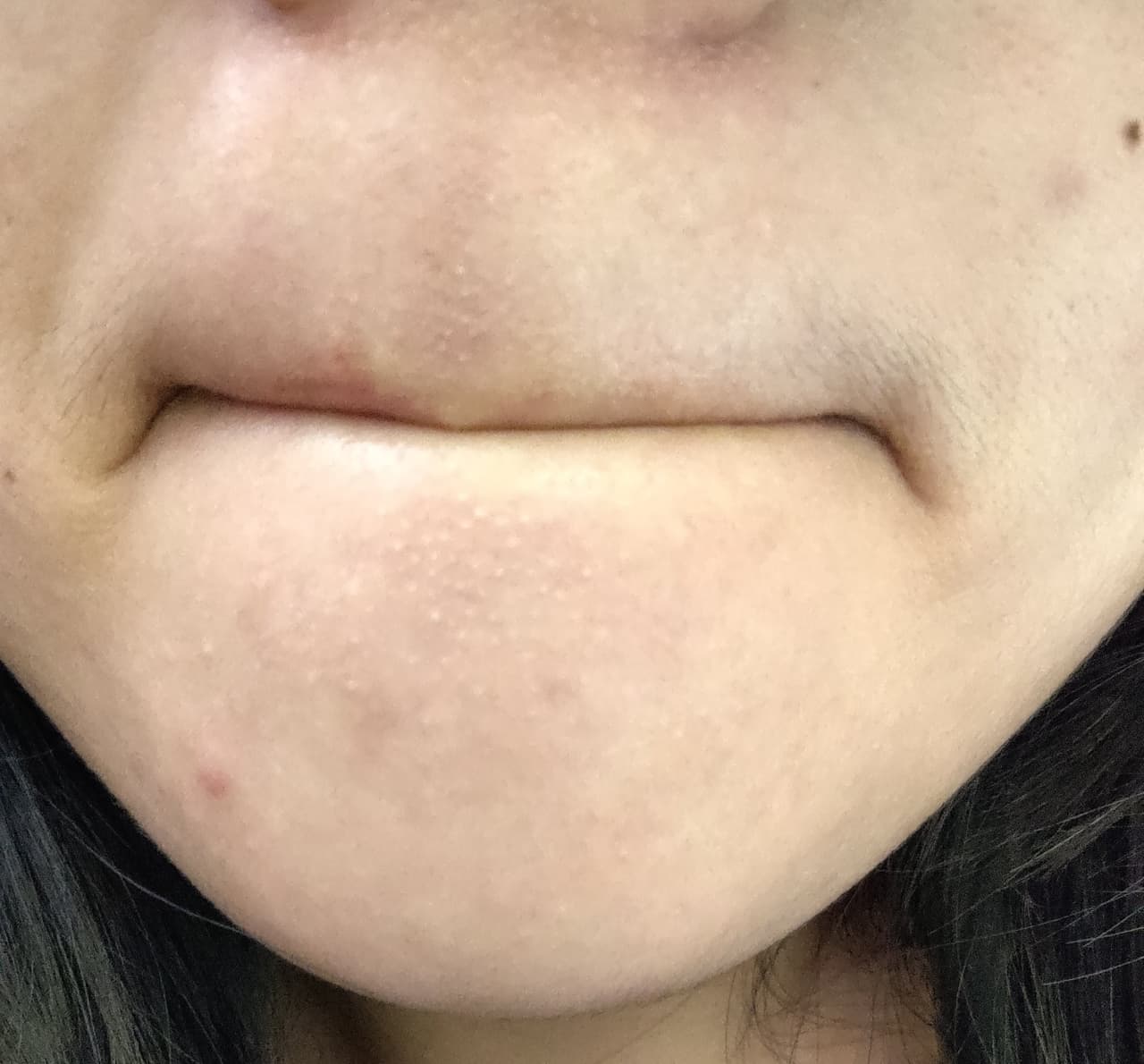 megapx
