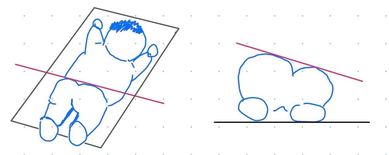 megapx