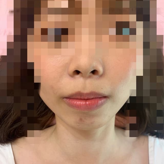 megapx