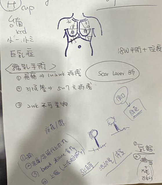 巨乳症 
