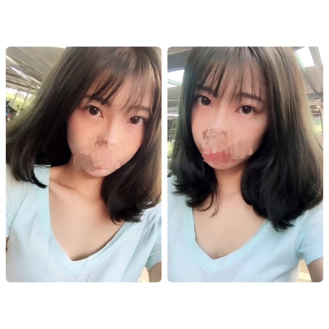 megapx