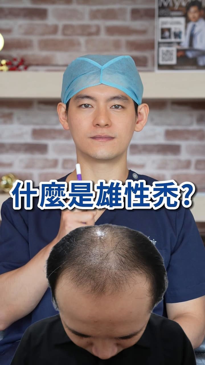 雄性禿是什麼？男女性雄性禿原因！ - MyHair 生髮植鬍診所 (@myhair_clinic) | Dcard